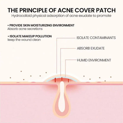 Invisible Hydrocolloid Star Pimple Patches – Overnight Spot Treatment